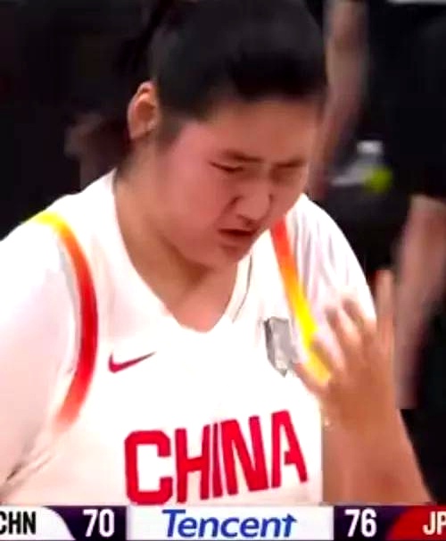 包含宫鲁鸣：张子宇有身高优势，但对她不能操之过急要防止其出现伤病的词条