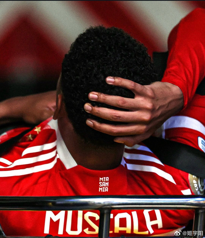 包含拜仁新星穆西亚拉腓骨骨折，将缺阵至少四个月！的词条  第1张