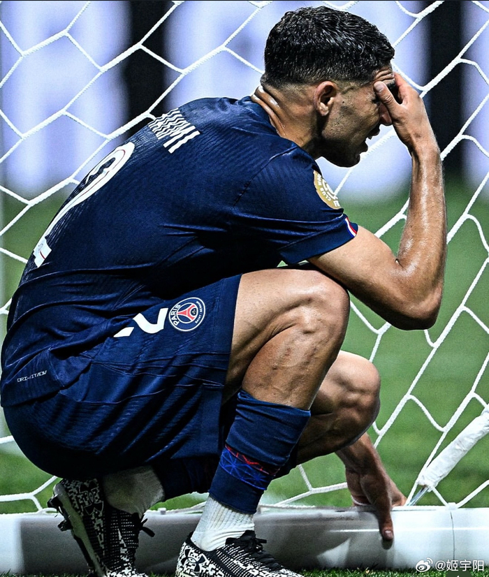 包含拜仁新星穆西亚拉腓骨骨折，将缺阵至少四个月！的词条  第2张