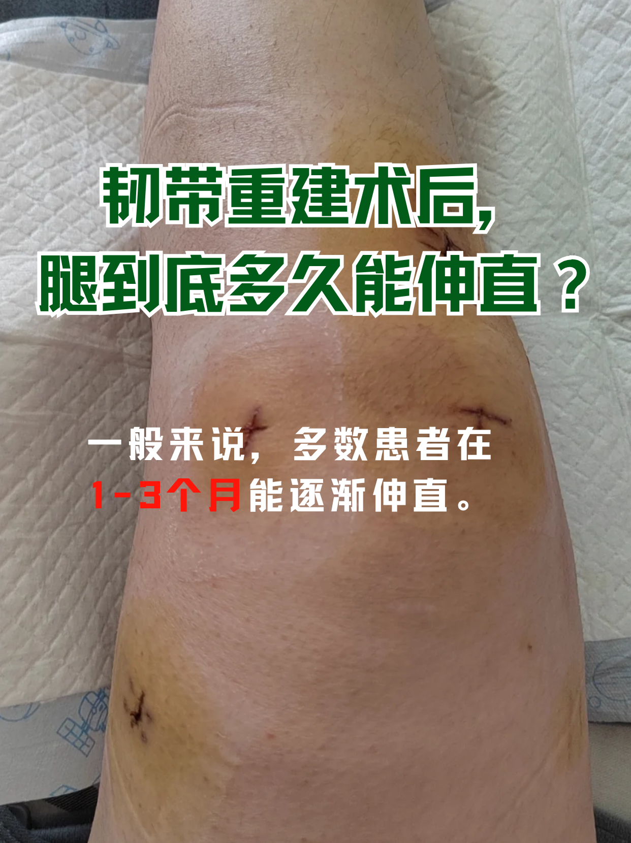 离谱!乔治休赛期训练受伤!左膝已接受手术的简单介绍 离谱!乔治休赛期训练受伤!左膝已接受手术的简单介绍